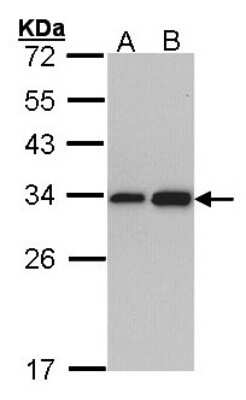 Western Blot: RPL8 Antibody [NBP1-33294]