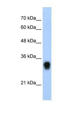 Western Blot: RPL8 Antibody [NBP1-57473]