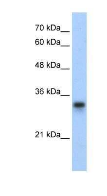 Western Blot: RPL8 Antibody [NBP1-57479]