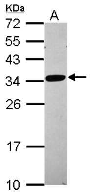 Western Blot: RPL8 Antibody [NBP2-20218]