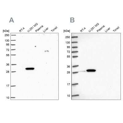 Western Blot: RPL8 Antibody [NBP2-47297]