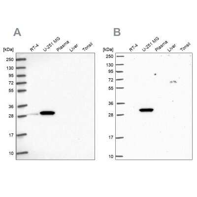 Western Blot: RPL8 Antibody [NBP2-48827]