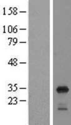 Western Blot: RPL8 Overexpression Lysate [NBL1-15546]