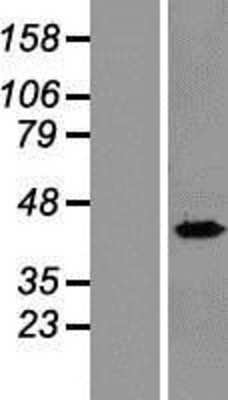 Western Blot: RPL8 Overexpression Lysate [NBL1-15547]