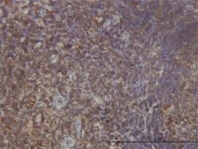 Immunohistochemistry-Paraffin: RPL9 Antibody (2F11) [H00006133-M01]