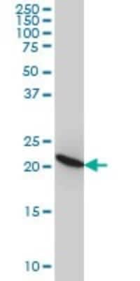 Western Blot: RPL9 Antibody (2F11) [H00006133-M01]