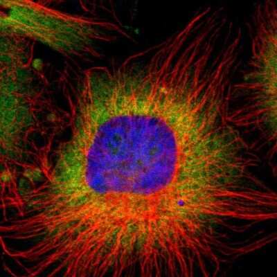 Immunocytochemistry/ Immunofluorescence: RPL9 Antibody [NBP1-82853]