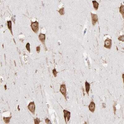 Immunohistochemistry-Paraffin: RPL9 Antibody [NBP1-82853]
