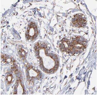 Immunohistochemistry-Paraffin: RPL9 Antibody [NBP1-82853]