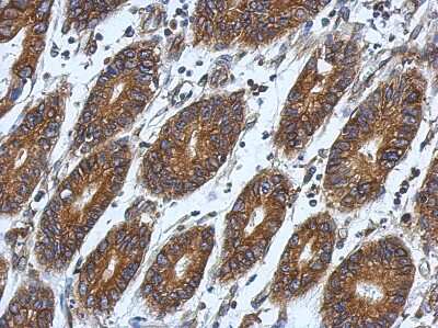 Immunohistochemistry-Paraffin: RPL9 Antibody [NBP2-20219]