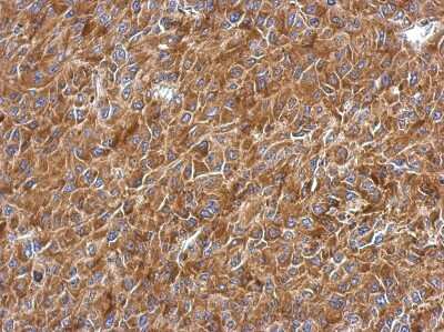 Immunohistochemistry-Paraffin: RPL9 Antibody [NBP2-20219]