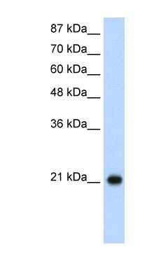 Western Blot: RPL9 Antibody [NBP1-57387]