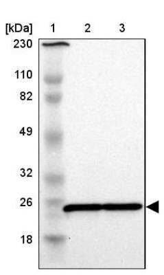 Western Blot: RPL9 Antibody [NBP1-82853]