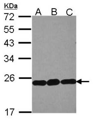 Western Blot: RPL9 Antibody [NBP2-20219]