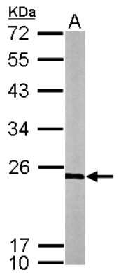 Western Blot: RPL9 Antibody [NBP2-20219]