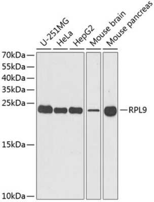 Western Blot: RPL9 AntibodyBSA Free [NBP2-93947]