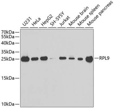 Western Blot: RPL9 AntibodyBSA Free [NBP2-94567]