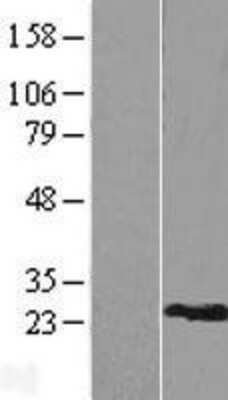 Western Blot: RPL9 Overexpression Lysate [NBP2-09173]