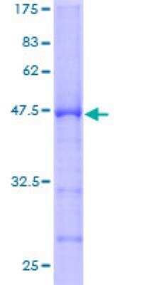 SDS-PAGE: Recombinant Human RPL9 GST (N-Term) Protein [H00006133-P01]