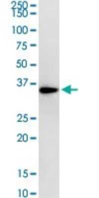 Western Blot: RPLP0 Antibody (1B4) [H00006175-M01]