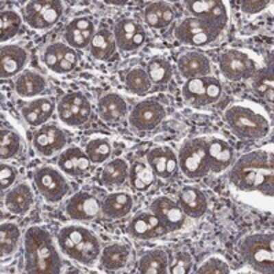 Immunohistochemistry-Paraffin: RPLP0 Antibody [NBP3-17763]