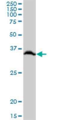 Western Blot: RPLP0 Antibody [H00006175-B01P]