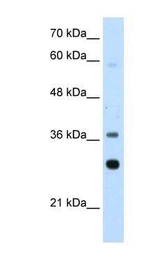 Western Blot: RPLP0 Antibody [NBP1-57528]