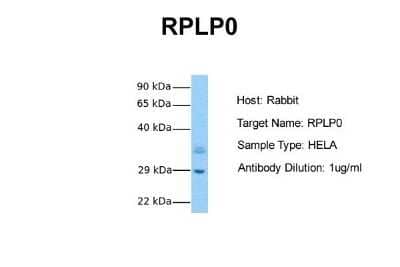 Western Blot: RPLP0 Antibody [NBP1-57528]