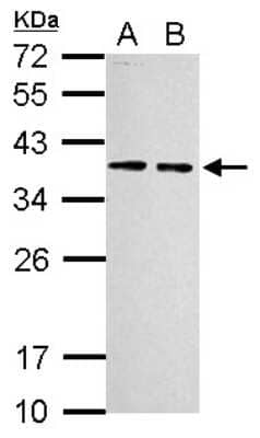 Western Blot: RPLP0 Antibody [NBP2-20220]