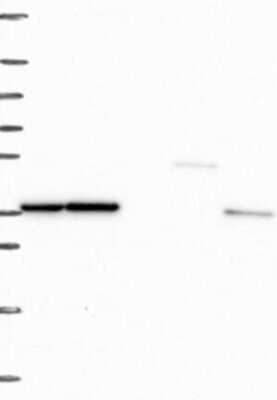 Western Blot: RPLP0 Antibody [NBP3-17763]