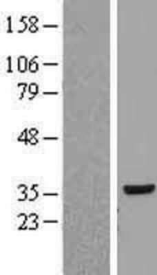 Western Blot: RPLP0 Overexpression Lysate [NBP2-09085]