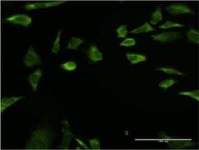 Immunocytochemistry/ Immunofluorescence: RPLP1 Antibody (1G10) [H00006176-M01]