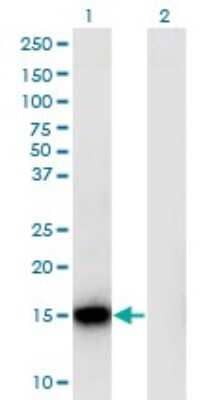 Western Blot: RPLP1 Antibody (1G10) [H00006176-M01]