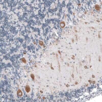 Immunohistochemistry-Paraffin: RPLP1 Antibody [NBP1-81293]