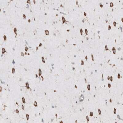 Immunohistochemistry-Paraffin: RPLP1 Antibody [NBP1-81293]