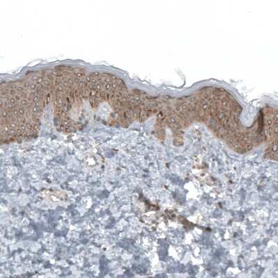 Immunohistochemistry-Paraffin: RPLP1 Antibody [NBP1-81293]