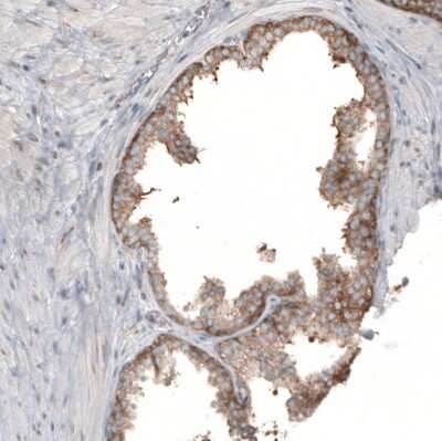 Immunohistochemistry-Paraffin: RPLP1 Antibody [NBP1-81293]