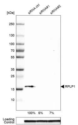 Western Blot: RPLP1 Antibody [NBP1-81293]