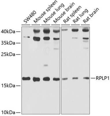 Western Blot: RPLP1 AntibodyBSA Free [NBP2-94116]