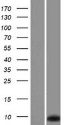 Western Blot: RPLP1 Overexpression Lysate [NBP2-04459]