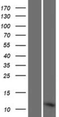 Western Blot: RPLP1 Overexpression Lysate [NBP2-08938]