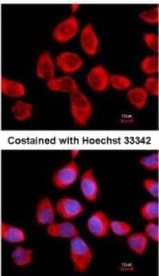 Immunocytochemistry/ Immunofluorescence: RPLP2 Antibody [NBP2-15104]