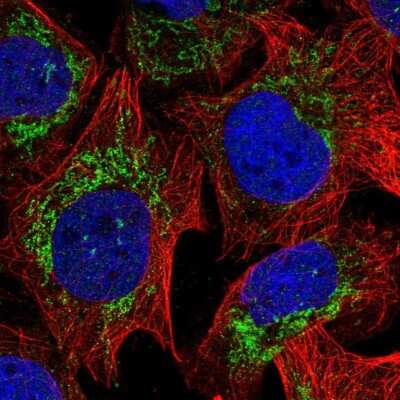 Immunocytochemistry/ Immunofluorescence: RPLP2 Antibody [NBP2-33688]