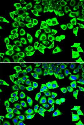 Immunocytochemistry/ Immunofluorescence: RPLP2 Antibody - BSA Free [NBP3-04413]