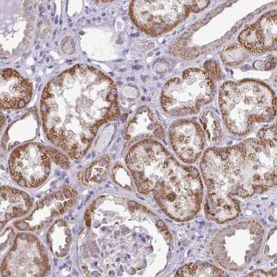 Immunohistochemistry-Paraffin: RPLP2 Antibody [NBP2-33688]
