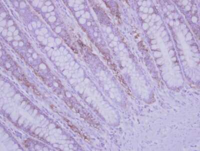 Immunohistochemistry-Paraffin: RPLP2 Antibody [NBP2-15104]