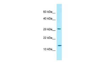 Western Blot: RPLP2 Antibody [NBP2-85659]