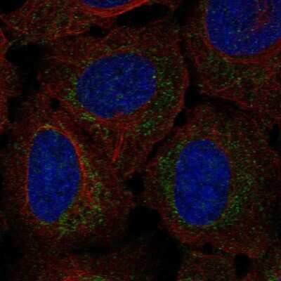 Immunocytochemistry/ Immunofluorescence: RPP14 Antibody [NBP2-57532]