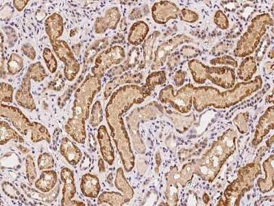 Immunohistochemistry-Paraffin: RPP14 Antibody [NBP2-98043]