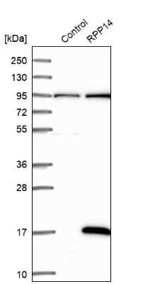 Western Blot: RPP14 Antibody [NBP1-80965]